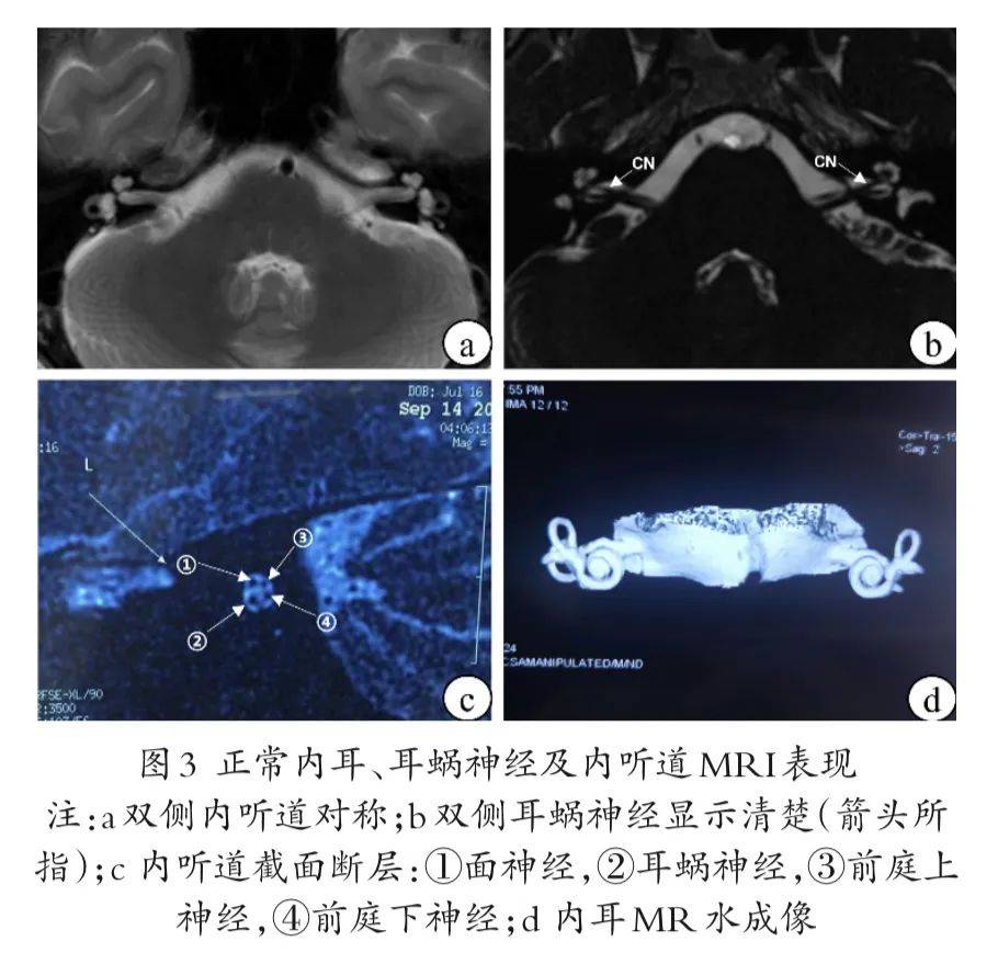大脑功能性影像学技术包括功能性磁共振成像 (fmri),正电子发射断层