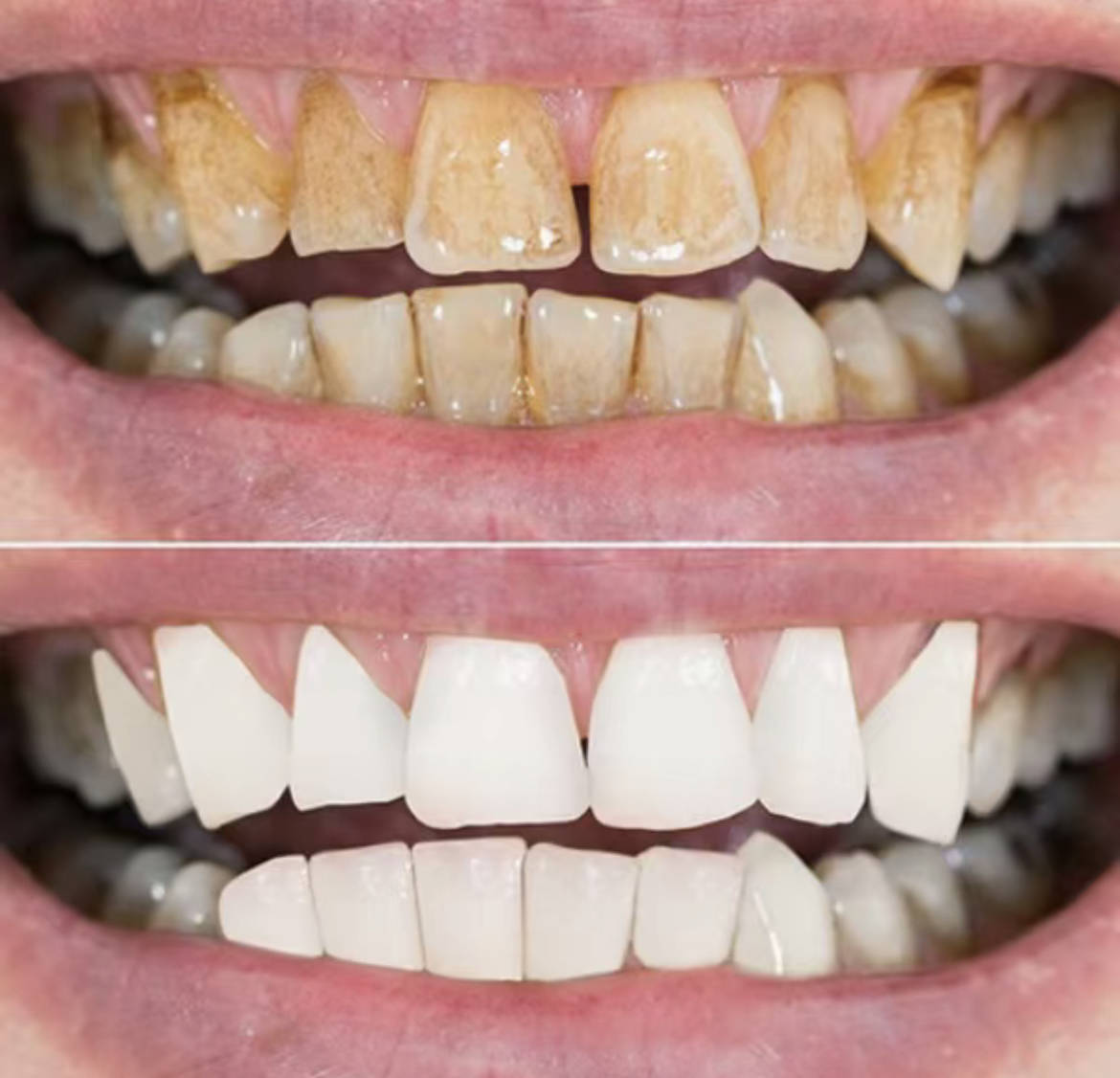 牙黄牙渍又脏又臭?过来人给你支一招,牙齿越刷越白!_效果_保护_经验