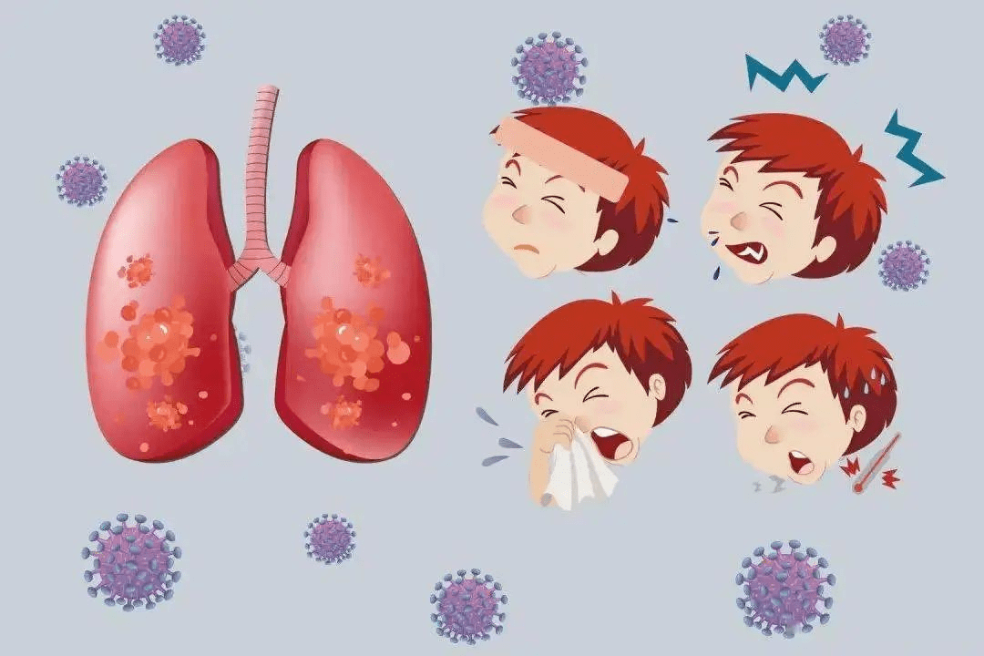 肺炎的疗程一般肺炎疗程大约7-10天,但是对于大叶性肺炎或重症肺炎