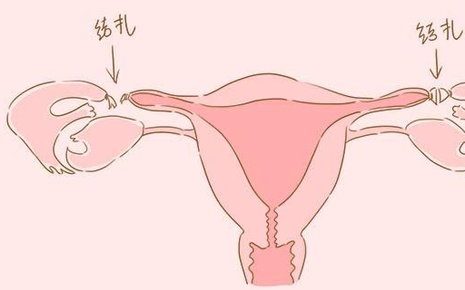 方式"既简单又安全,若你老公愿去,说明你找到真爱了_男性_手术_影响