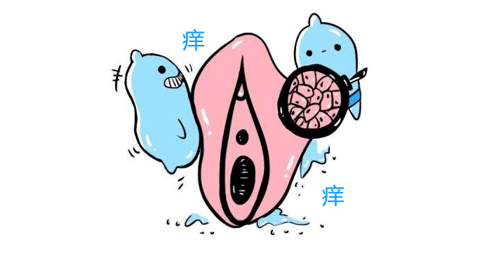 昆明良方外阴白斑研究中心-如何初步判断自己是否患有外阴白斑?