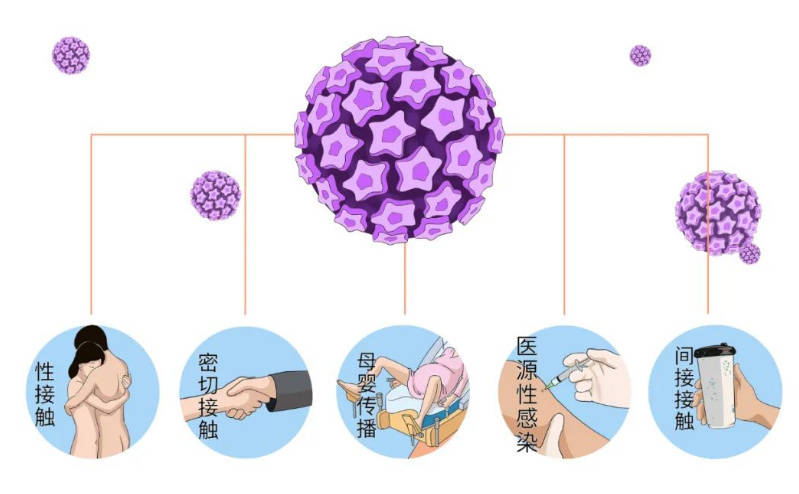 薇润提醒感染hpv不等于宫颈癌!_病毒_细胞_黏膜
