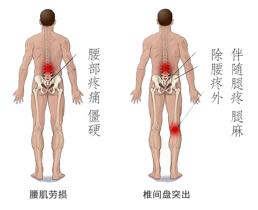 百草益寿:学会古法通背 不花一分钱赶走腰间盘突出 腰肌劳损