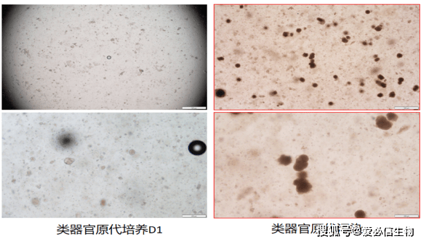 人腦膠質瘤類器官培養攻略_ml_abs_組織