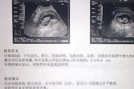 怀孕6周b超单图片