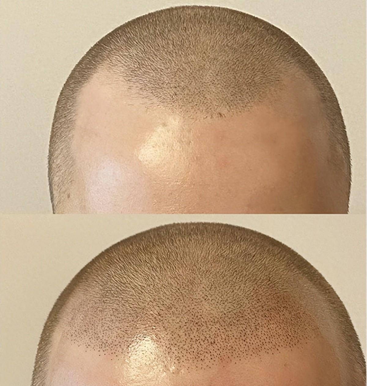 smp 头发纹身教程