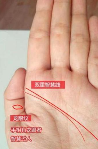 手相中出现"龙眼纹",龙眼纹为封闭的圆形或者椭圆形图案符号,出现在大