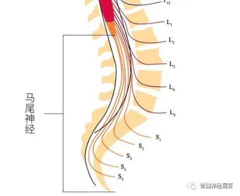 支配膀胱括約肌及肛門括約肌的骶神經根(骶2-骶4)位於椎管中線,更易