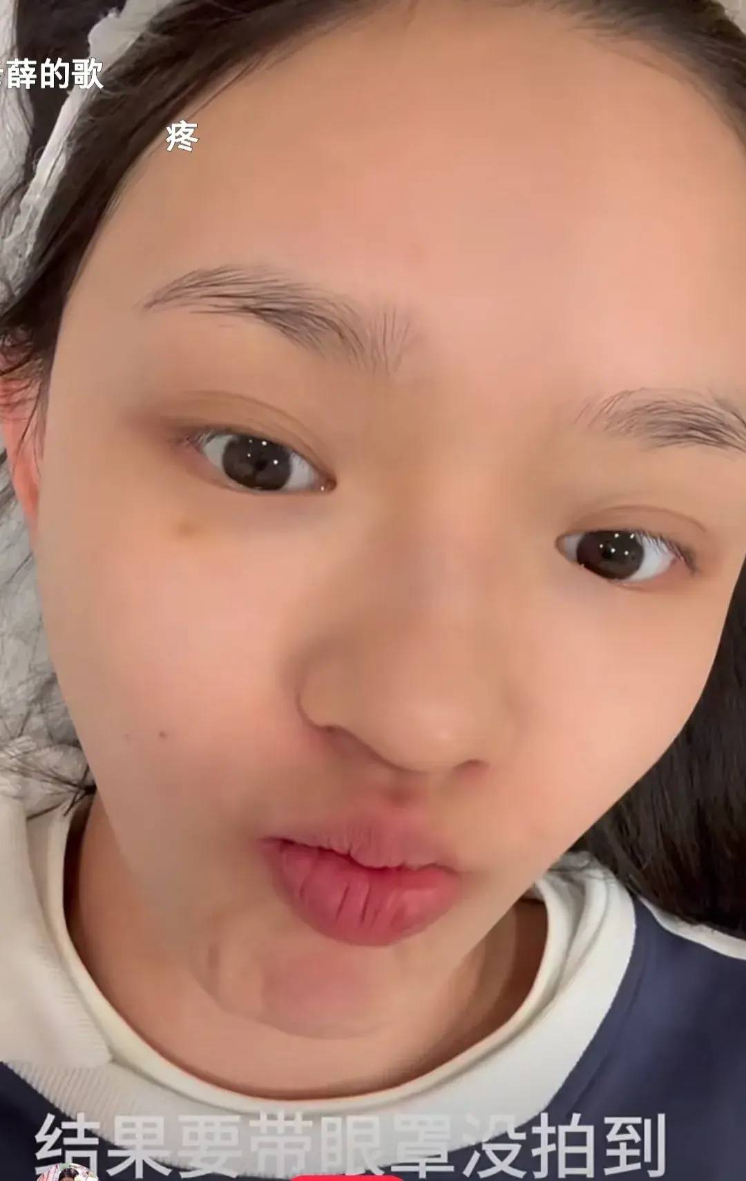 知名小花大胆晒医美照,娱乐圈的大哥大姐都向她学习吧别再死扛了_林允