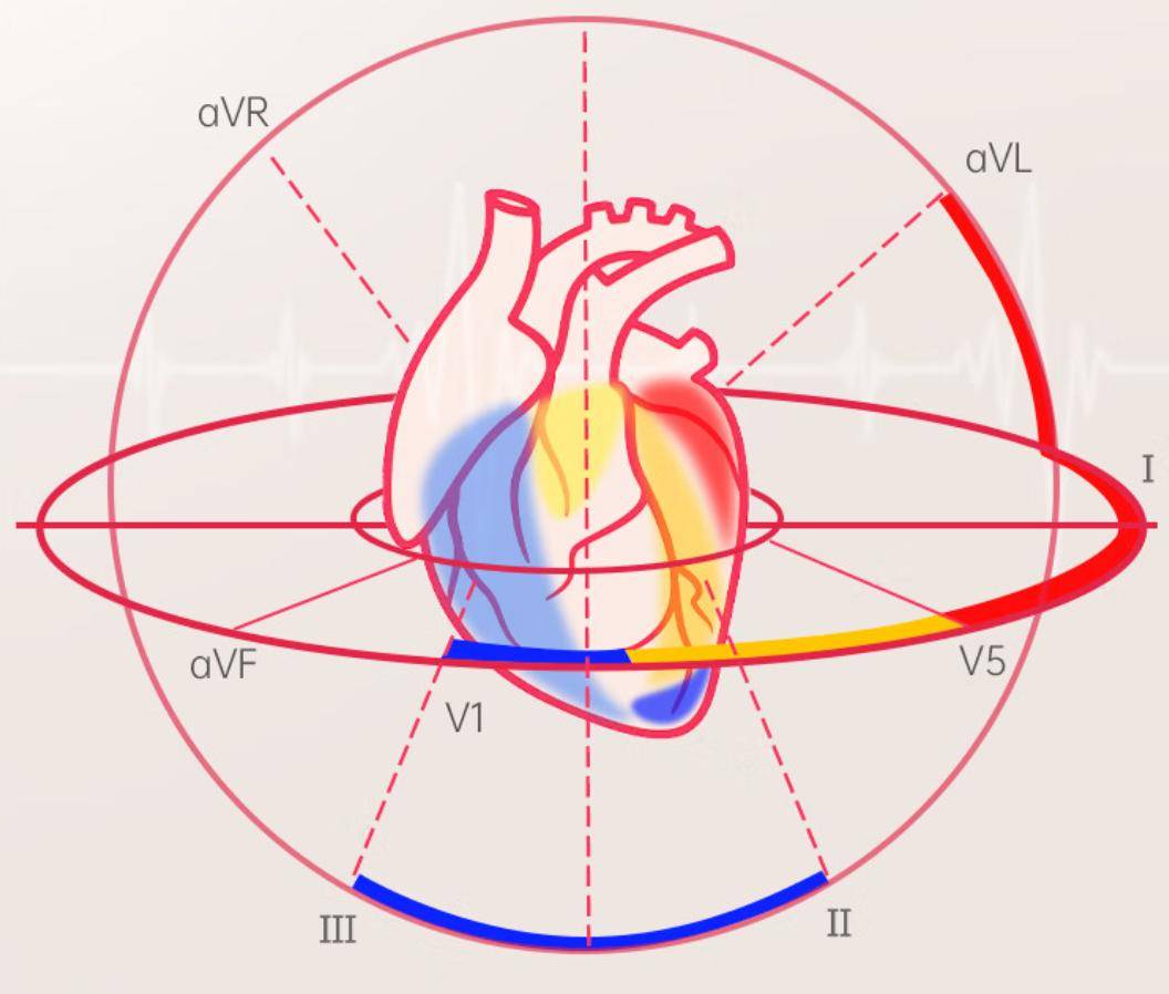胸导联位置图片图片