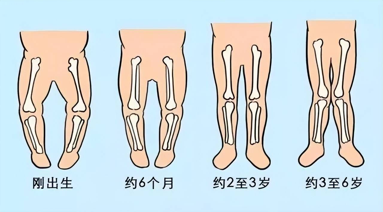 傷害寶寶腿部發育的5種行為,很多老人還在做,爸媽別不以為意_奶奶_不