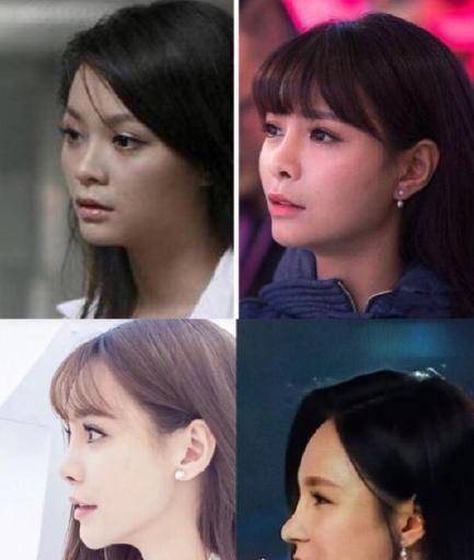 "换头改命"的8位女星,谁才是真正的王者?