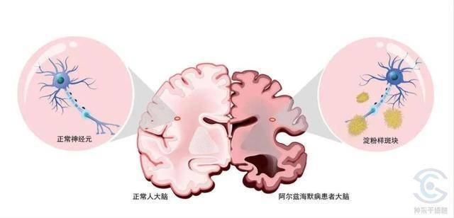 调节麻痹是指 来自搜狐网