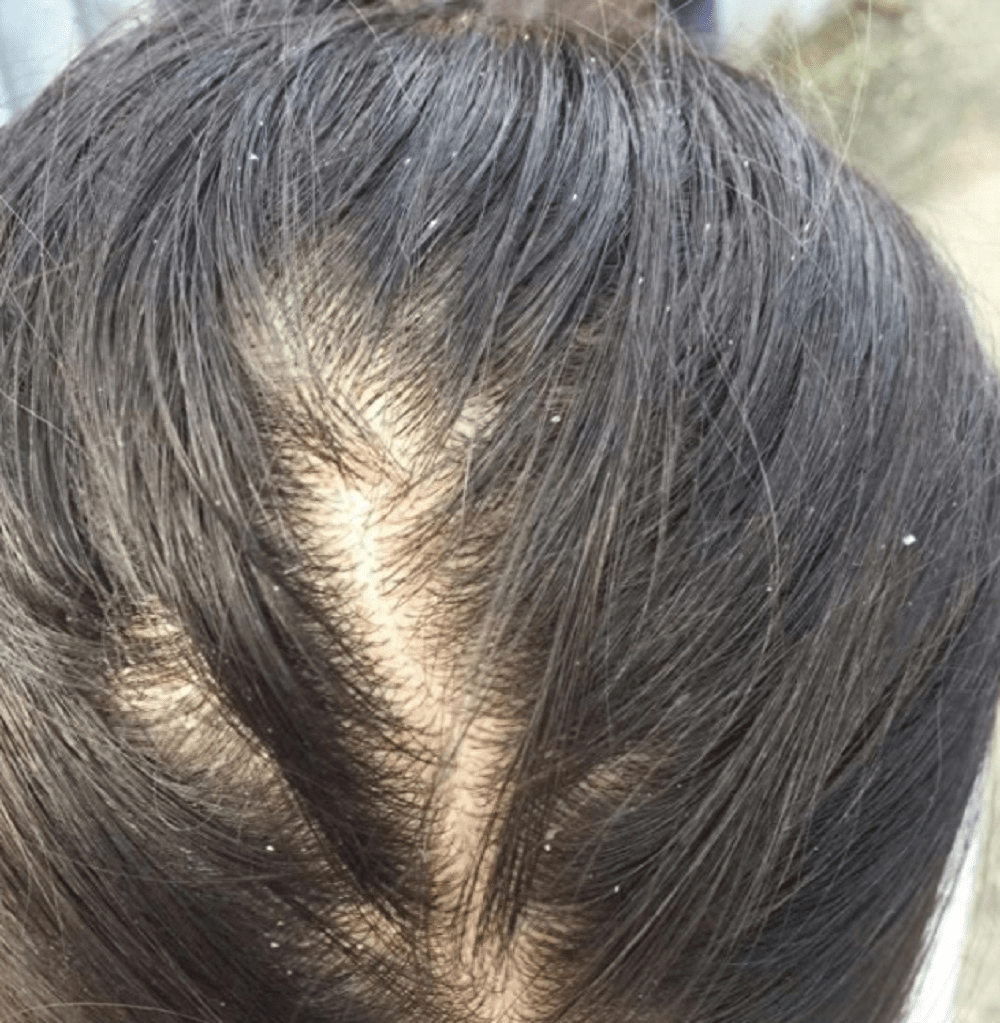 学会以下几点,轻松成为统治时尚的美丽女性_头发_问题_头皮