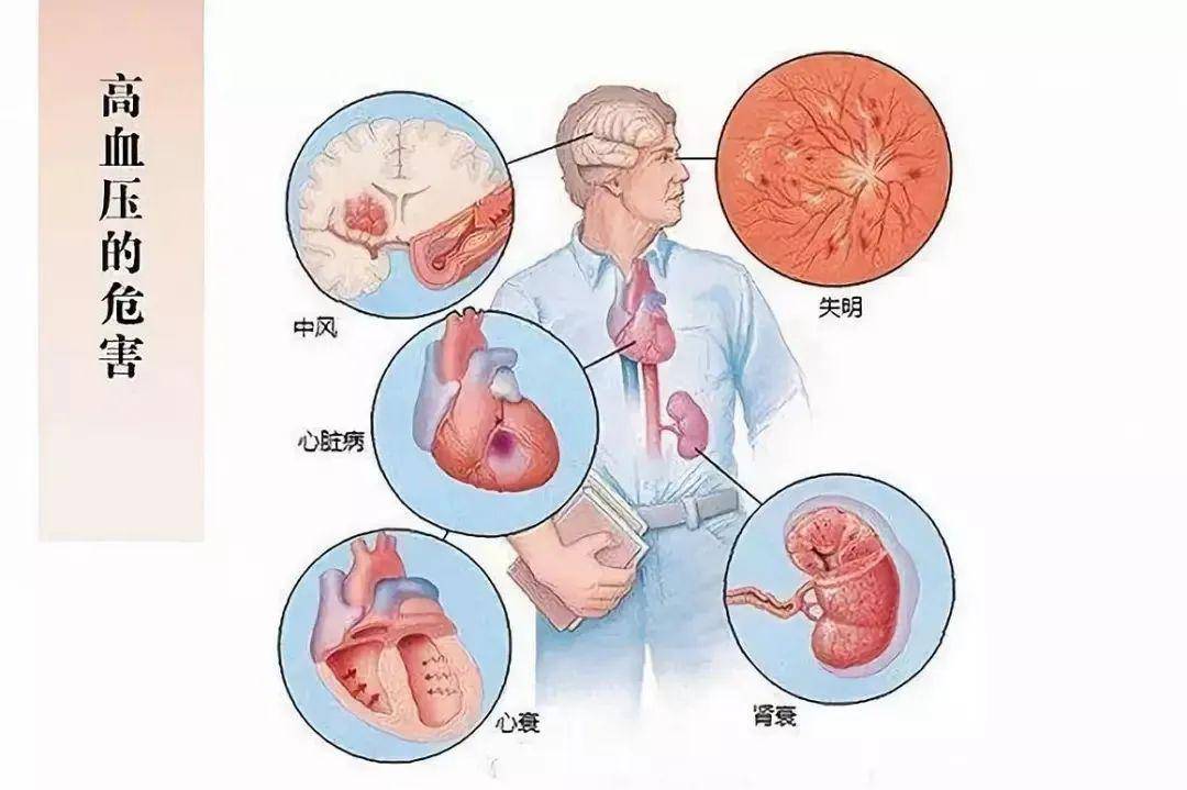 慢性腎臟病為什麼要嚴格控制血壓