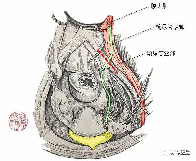 女性输尿管的位置图图片
