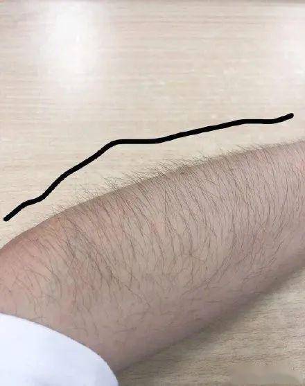 女生汗毛太多的烦恼看了女网友晒的图感觉山药棍子成精了