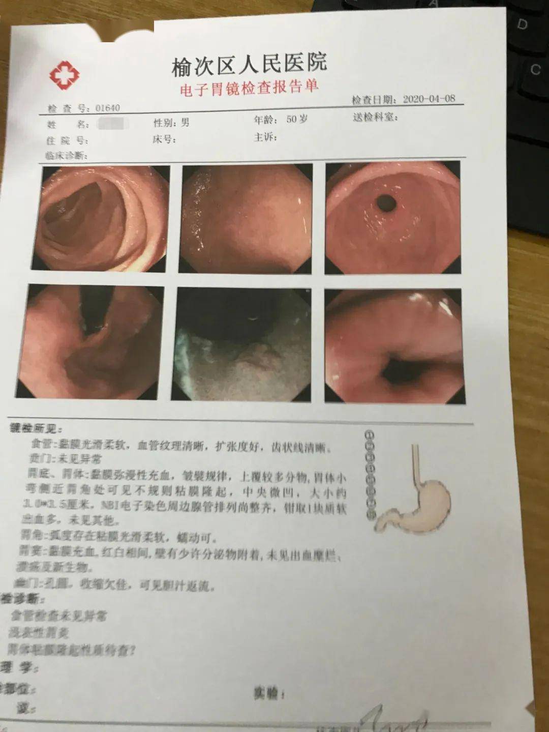 【医院新闻】榆次区人民医院陈星博士工作站开诊 完成首例胃体黏膜下