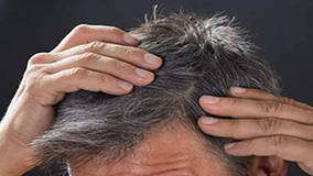 男人白发越来越多是肾虚？