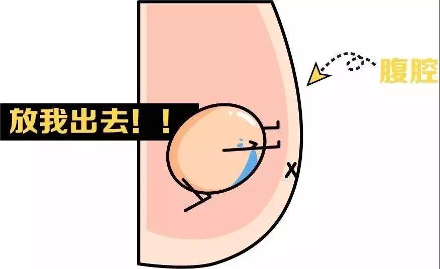 只有一个睾丸其实这是隐睾症