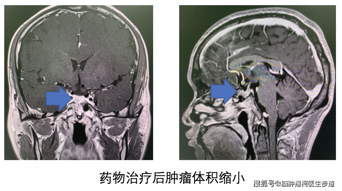 fe34057de1e84095b632f6258e51c02b.png