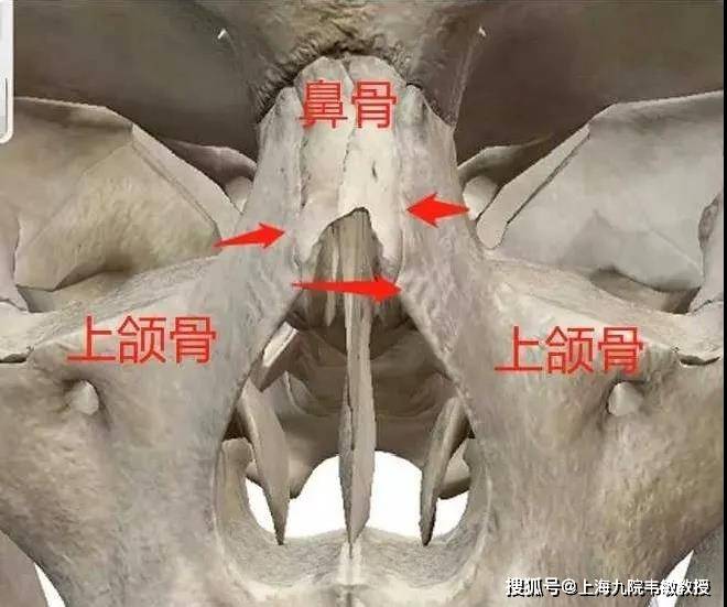 鼻骨正常图片图片