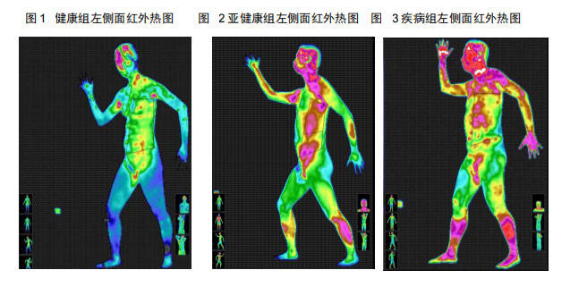 4红外热成像技术的特点红外热像仪系被动地接收人体的自身辐射而形成