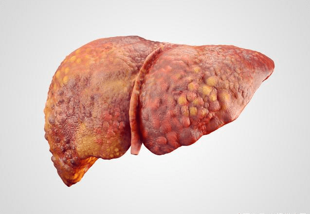 汗孔|若这3个部位经常“发臭”，或许是肝脏在向你“求救”，莫忽视