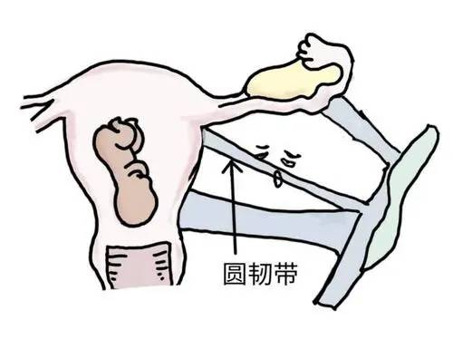 原创妊娠期圆韧带疼痛圆韧带疼痛和腹部痉挛有什么区别该如何处理