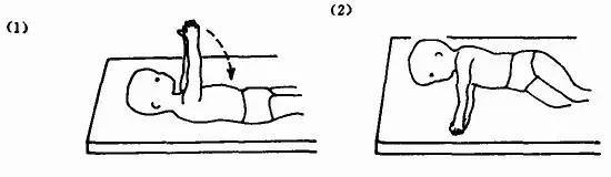 上肢|偏瘫患者的日常康复训练手法图解