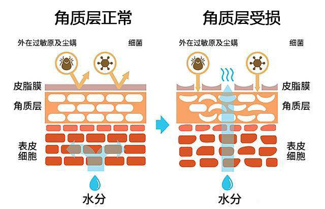 镇静|关于肌肤角质层受损的那些事儿——如何科学修复受损角质层？