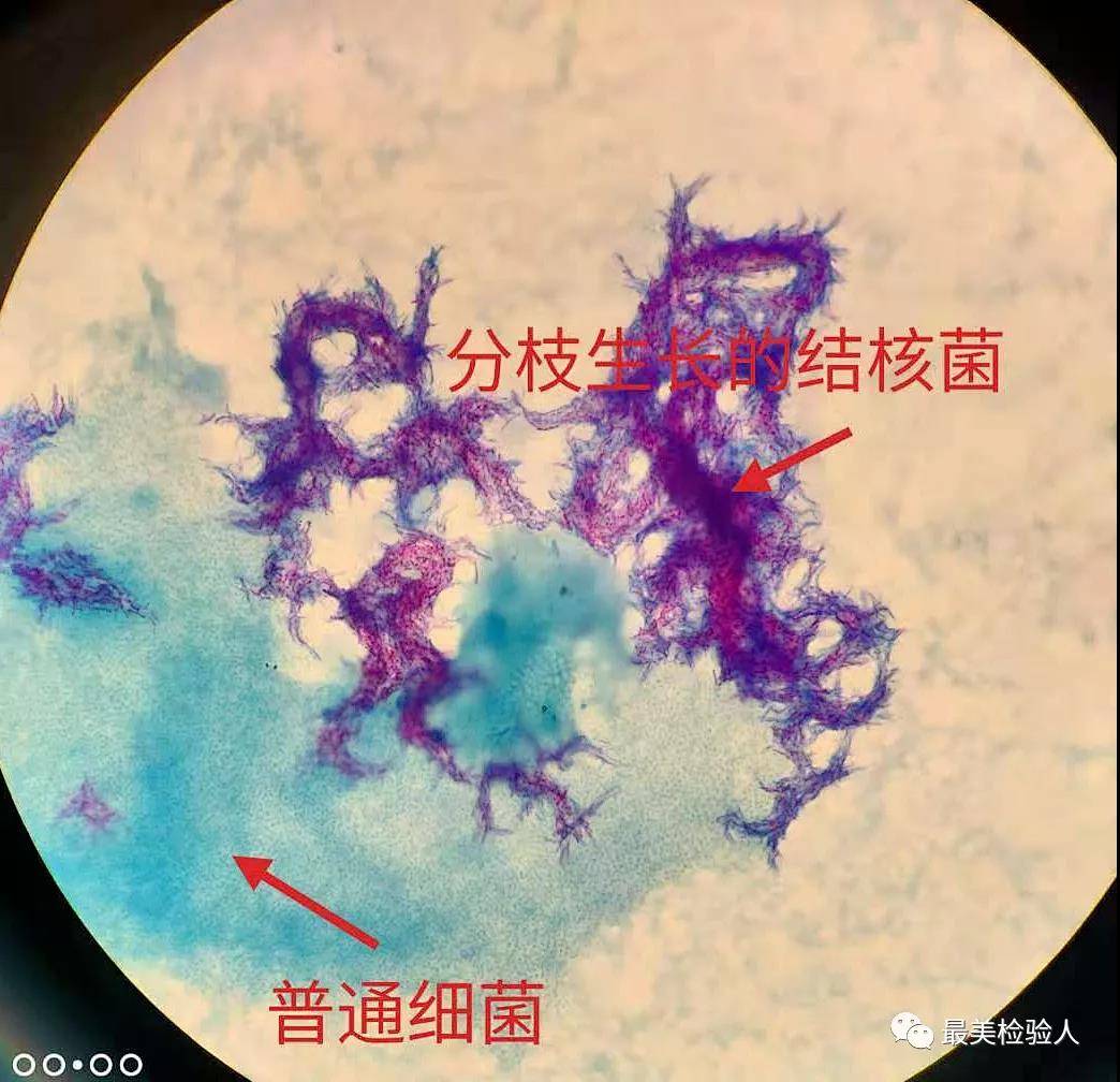 母牛分枝杆菌图片