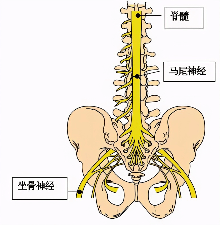 孔镜|76岁大妈经常“走走停停” 专家：当心腰椎管“缩水”