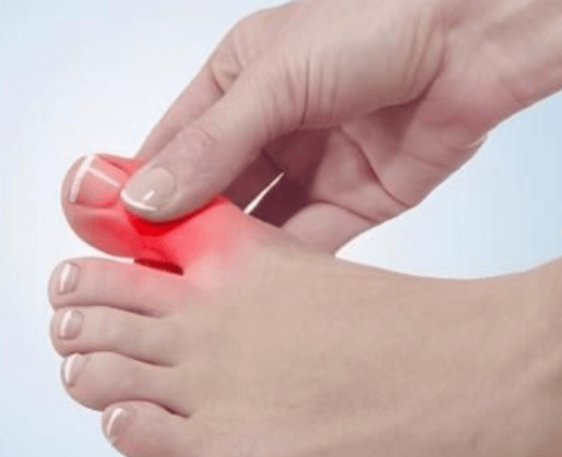 关节出现4个症状或许是尿酸偏高2方面调理远离痛风