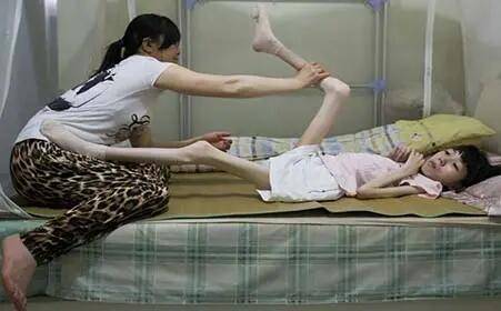 百草|肌萎缩侧索硬化症是渐冻症吗-推荐