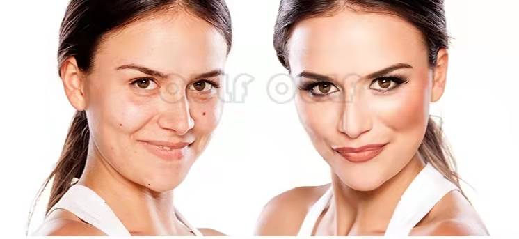 消息资讯pst面部提升多少钱；pst面部提升效果怎么样再无被叫老阿姨的感受~