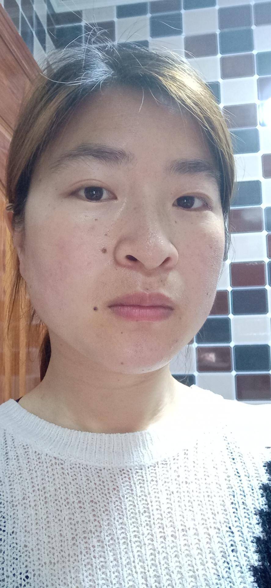什么|je莫倩:激素脸流水怎么办?什么是激素脸?