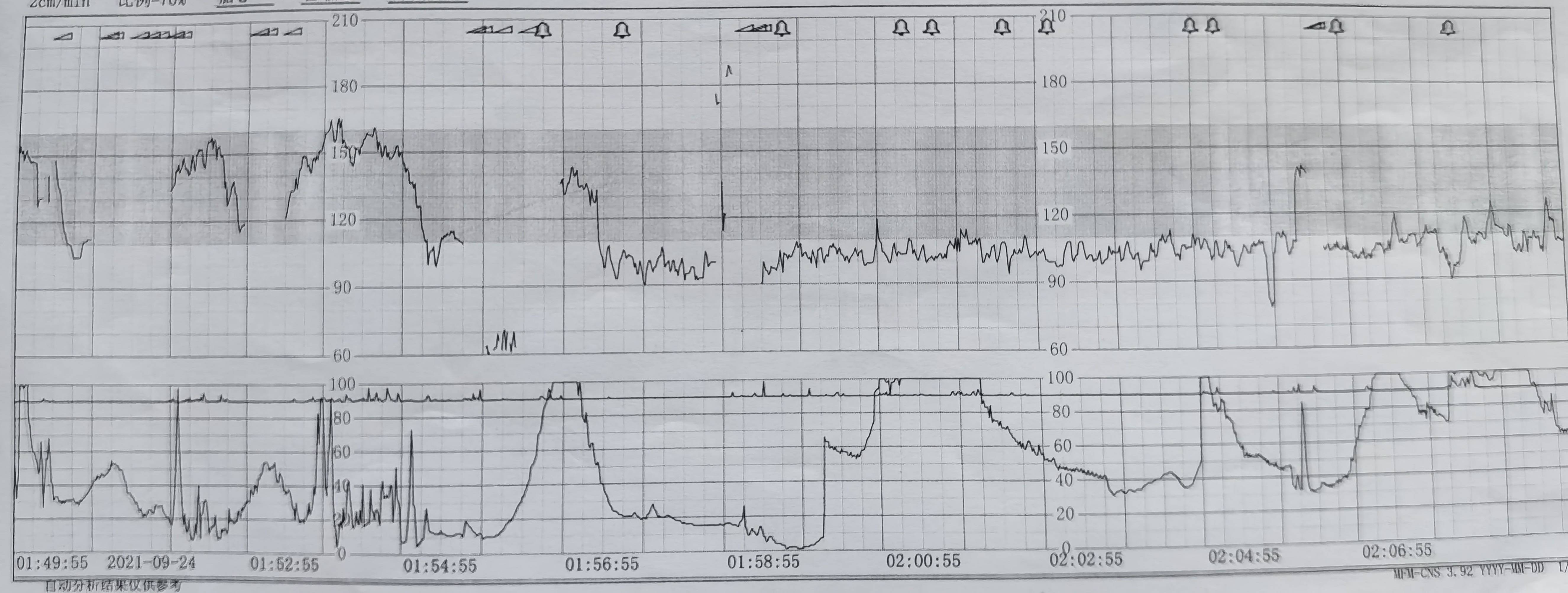 住院|妈妈安全，孩子优先，在产科，你永远不知道下一步会遇上什么坑！