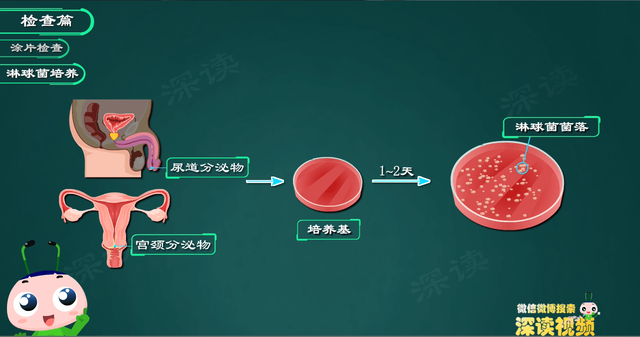 得了淋病遭罪不说，还易复发，该咋办？快看看你的药都用对了吗？