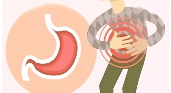 关注萎缩性胃炎