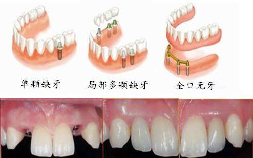 28颗牙齿代表什么命
