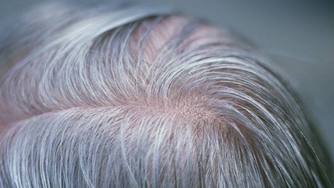 bbc:伦敦大学发现白发基因 人类毛发有望老而不白