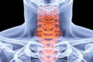 感觉|渐冻人和颈椎病有关系吗？