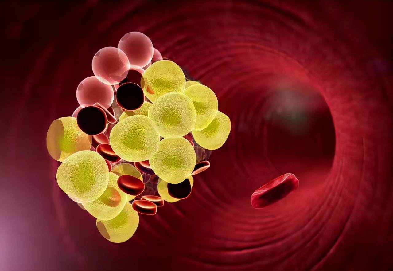 血液黏稠度受红细胞比容,血浆黏度,红细胞变形能力和红细胞聚集度的