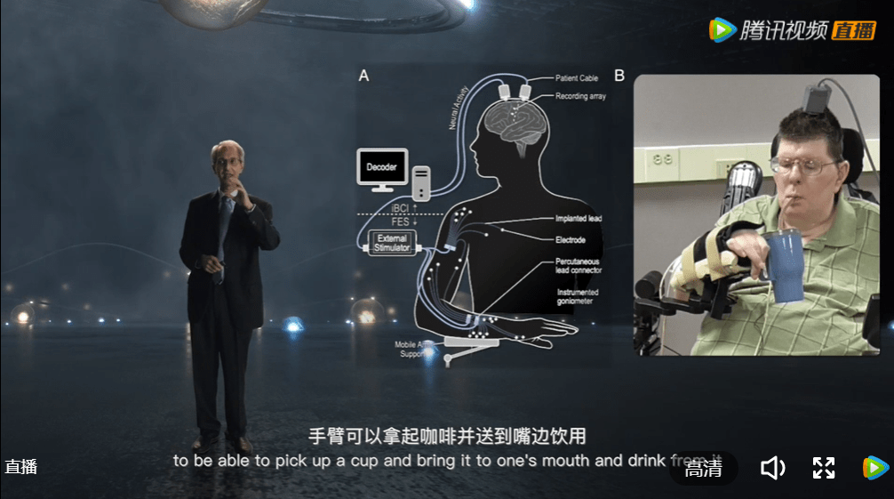 接口|2021腾讯科学WE大会---脑机接口技术
