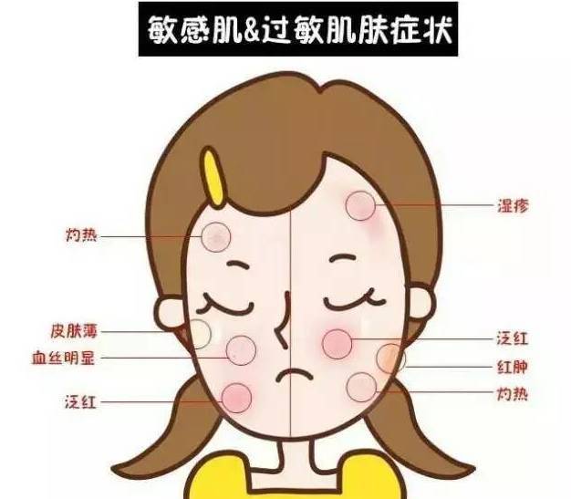 功效敏感性皮肤的问题解析？为什么你的皮肤会成为敏感肌？