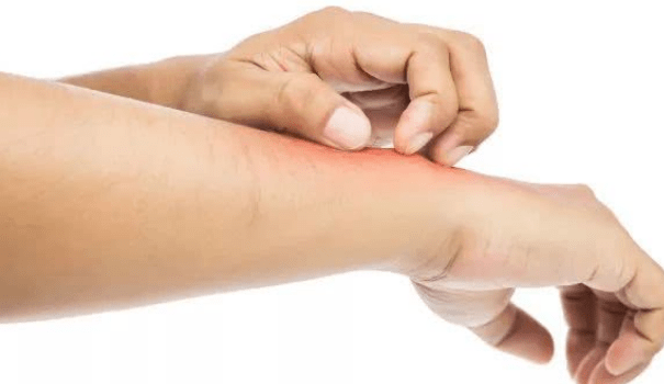 症状|身上2处“发痒”，别再傻傻以为是皮肤过敏，肝脏或早已“烂如渔网”