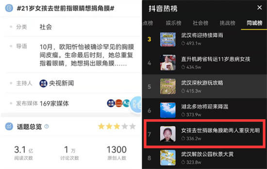 媒体|21岁女孩去世前指眼睛想捐角膜 武汉普瑞眼科角膜移植助2人获光明