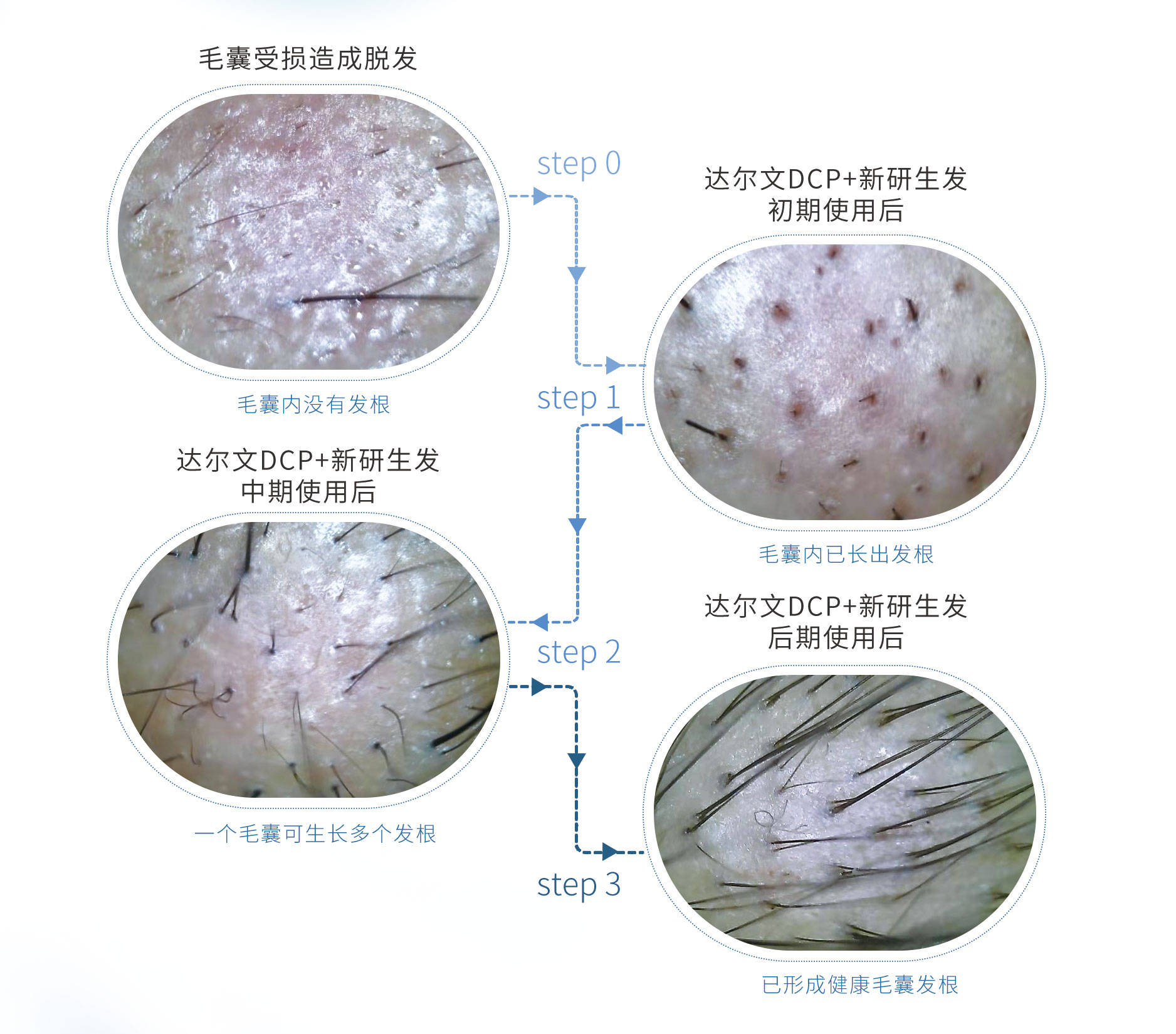 当我们在讲毛囊修复时 我们在修复什么?