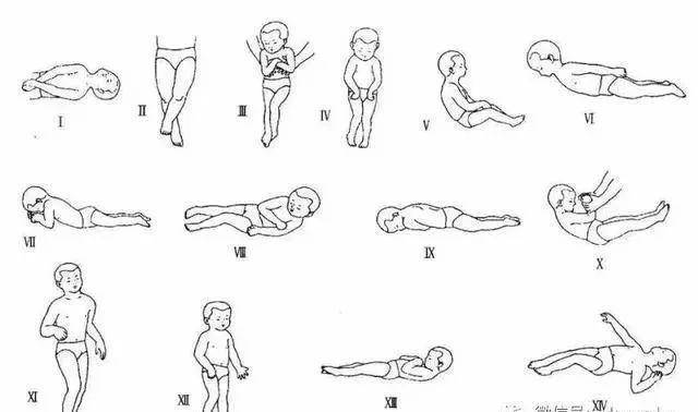 变性|痉挛性截瘫一定会瘫痪吗?